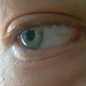 Epellone